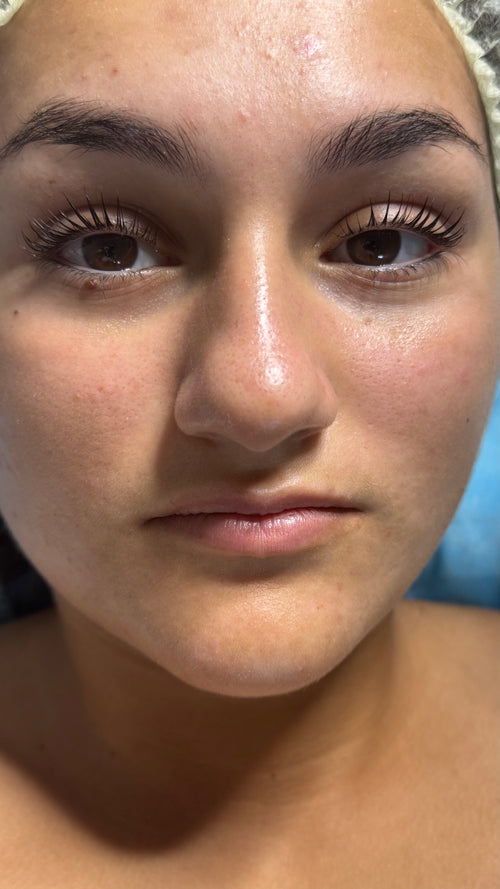 Facial cleansing (full course)